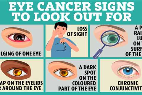 The first signs of cancer you might spot in your eyes – from floaters to blurred vision