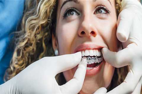 Straighten Your Teeth With Ease: Finding The Best Invisalign Dentist In Austin