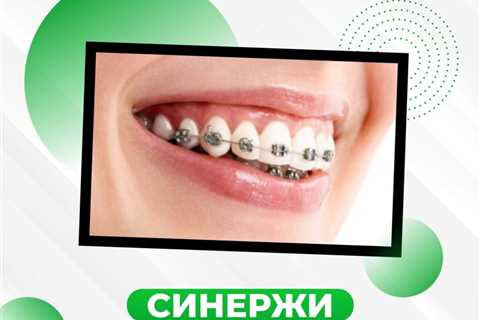 Шүдний аппарат 5 төрөл ба үнэ - PRODENT