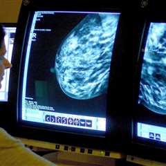Alarming Number of Women Skipping Breast Cancer Screenings, Charity Warns