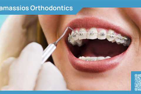 Standard post published to Tamassios Orthodontics - Orthodontist Nicosia, Cyprus at January 04,..