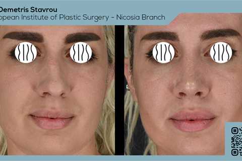 Standard post published to Dr. Demetris Stavrou - European Institute of Plastic Surgery - Nicosia..