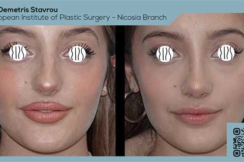 Standard post published to Dr. Demetris Stavrou - European Institute of Plastic Surgery - Nicosia..