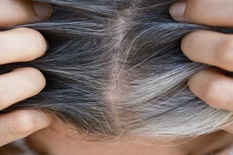 Can Stress Really Turn Your Hair Gray?