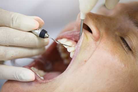 Fix receding gums without surgery