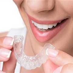 Unlocking Your Smile: Invisalign In Rockville, MD