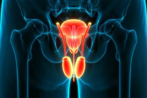 Does Ejaculation Frequency Influence Prostate Cancer Risk?