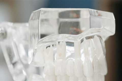 Revolutionize Your Oral Health Journey: Teeth Implants In Gainesville, VA, With TENS In Dentistry