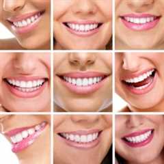 Negative Erfahrungen mit Zahnaufhellung: Wie man sie vermeidet