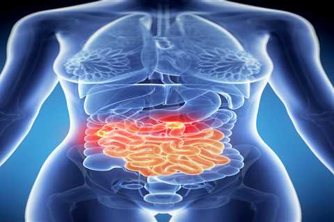 'Remarkable' Bowel Cancer Drug Shows 100% Effectiveness