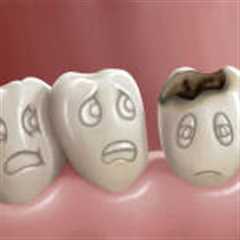 Understanding Tooth Decay: Prevention, Symptoms, and Treatment