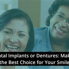 Dental Implants or Dentures: Making the Best Choice for Your Smile