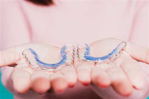 The Dos and Don’ts of Cleaning Retainers