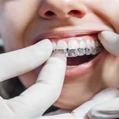 How to Prevent Clear Braces From Staining