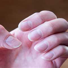 Understanding the Battle: Nail Psoriasis vs. Nail Fungus