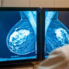 AI in NHS Clinics Detects Breast Cancer Cases Earlier and Faster