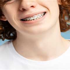 Signs It’s Time to Consider Braces for Your Child in Marietta