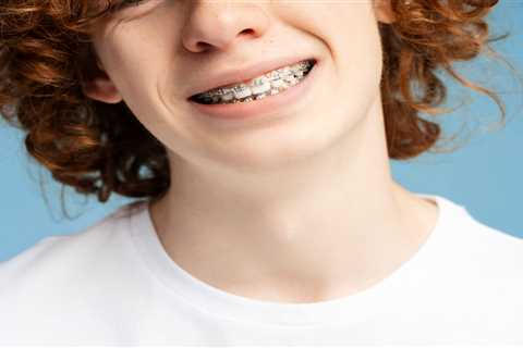 Signs It’s Time to Consider Braces for Your Child in Marietta