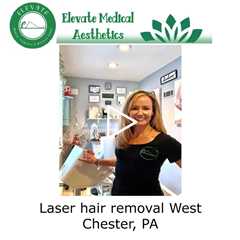 Laser hair removal West Chester, PA - Elevate Medical Aesthetics