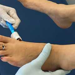 Diabetic Wound Care