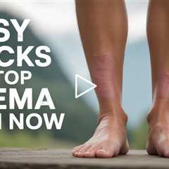 Easy Tricks to Stop Edema Pain Now