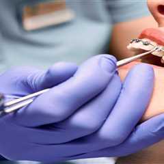 Why Standard Metal Braces Remain a Trusted Choice by Orthodontists