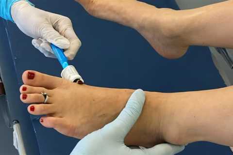 Diabetic Wound Care