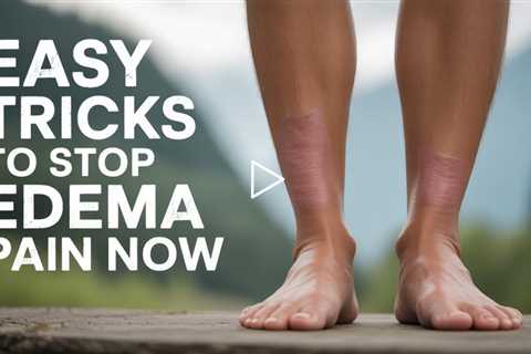 Easy Tricks to Stop Edema Pain Now