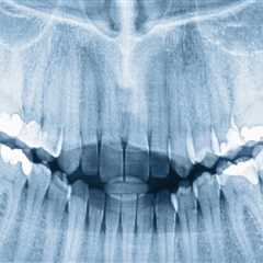 The Role of Dental X-Rays in Orthodontics in Seattle