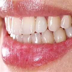 Transform Your Smile with Dental Implants and Orthodontics