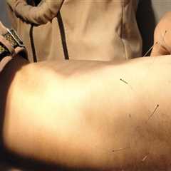 Discover Electroacupuncture Benefits in Portland