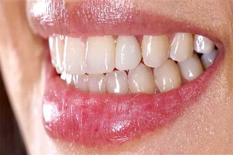 Transform Your Smile with Dental Implants and Orthodontics