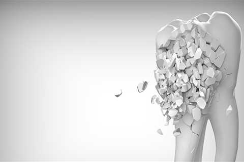 Understanding the Benefits of Dental X-Rays in Alexandria