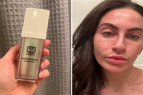 Revolutionary At-Home Peel Saves Americans Hundreds on Skincare