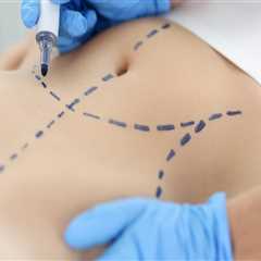 Enhance Comfort and Confidence: Liposuction for Back Injuries