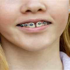 Are Metal Braces Right for Your Child? A Parent’s Guide
