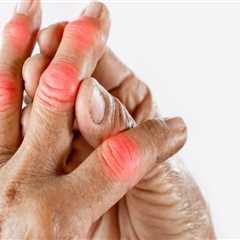 Understanding the Side Effects of Arthritis Therapy