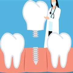 Understanding Dental Implant Surgery in North Little Rock