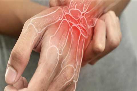 Understanding Who Can Benefit from Arthritis Therapy