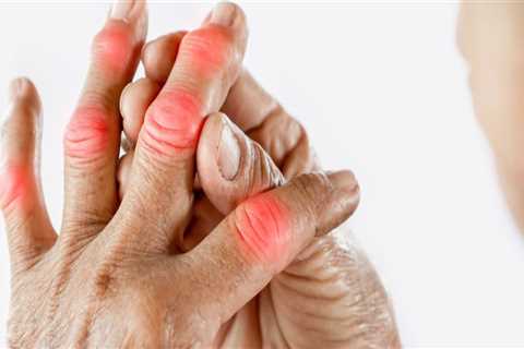 Understanding the Side Effects of Arthritis Therapy