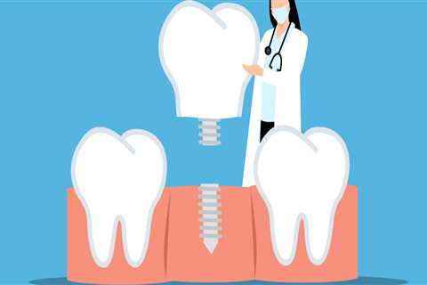 Understanding Dental Implant Surgery in North Little Rock